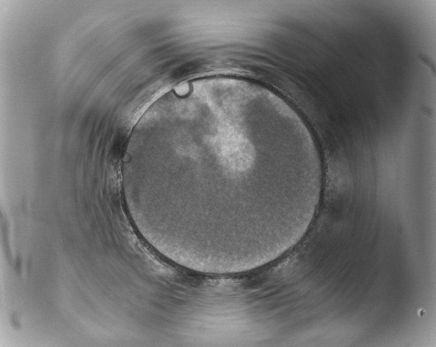 X0000103961377200810171852