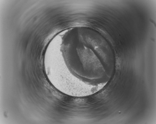 X0000103961419200810171852