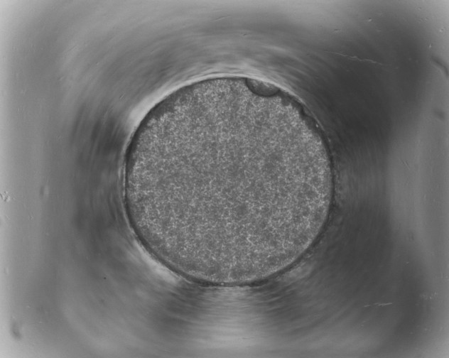 X0000103971519200810171913