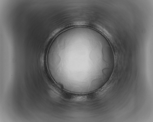 X0000110320155200905281639