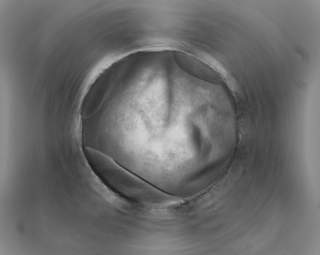 X0000110321472200906111442