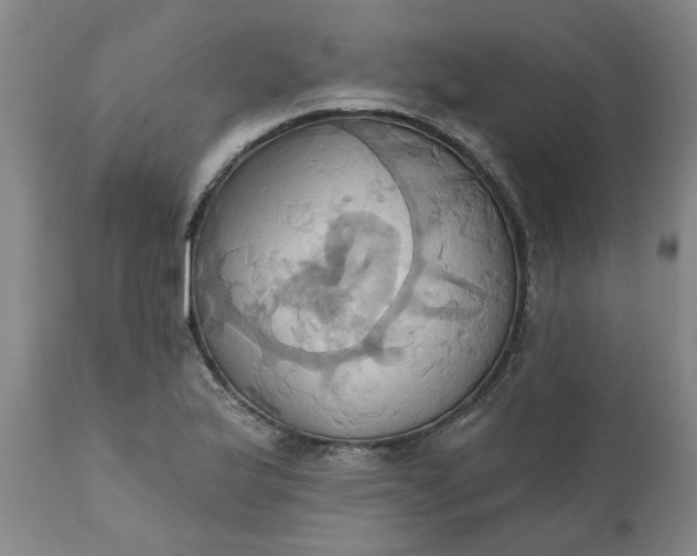 X0000110681175200906261314