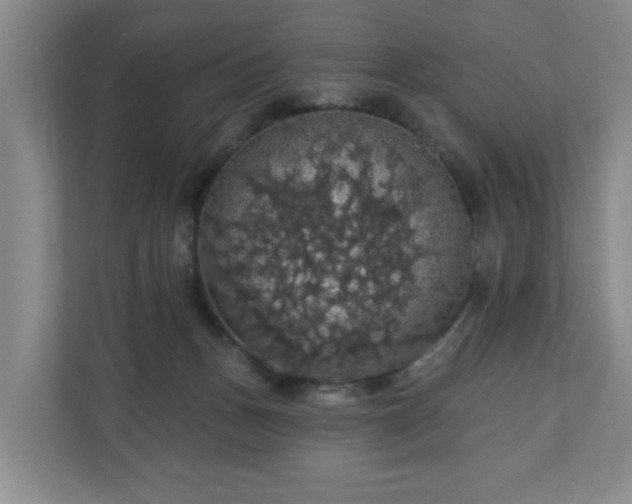X0000110700175200906191534