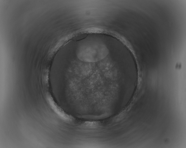 X0000110700057200906261417