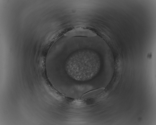 X0000110700280200906261415