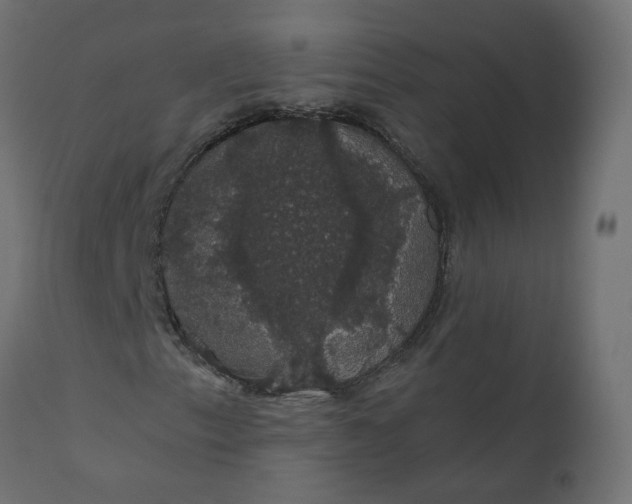 X0000110701153200906261401