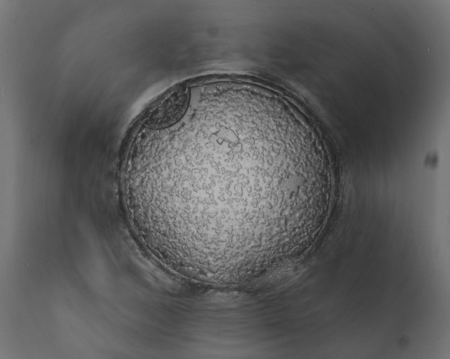 X0000110701168200906261400