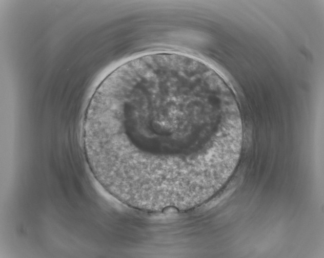 X0000110701535200907241115
