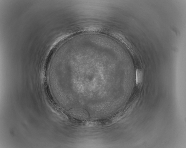 X0000110710579200906121356