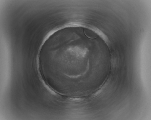 X0000110711382200906191539