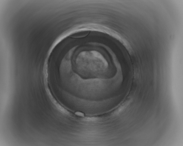 X0000110711522200906191537