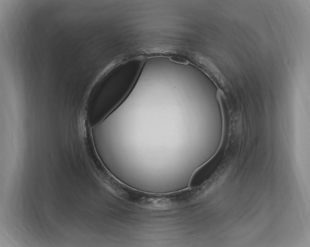 X0000110740395200906150933