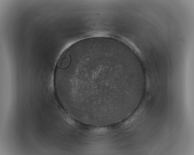 X0000110761174200906151300