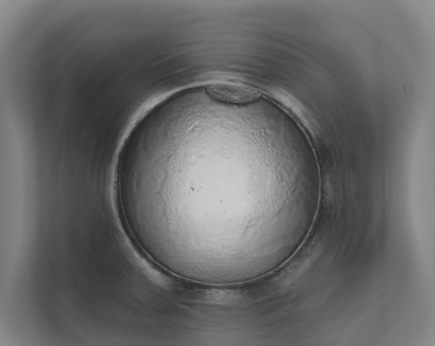X0000110761379200906221113