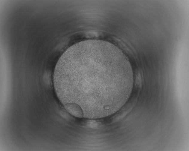 X0000110760616200906291029