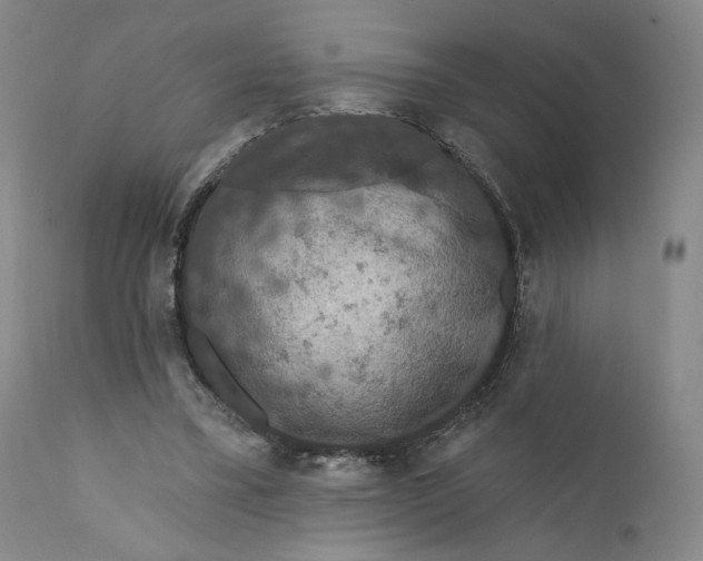 X0000110760395200907061100