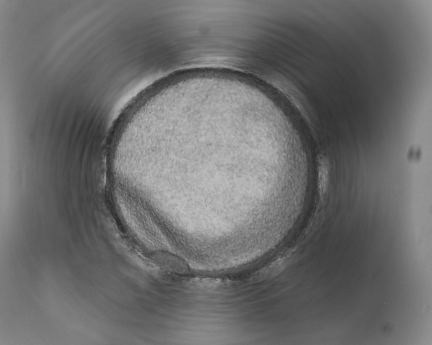 X0000110761069200907061049