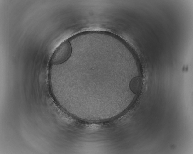 X0000110761173200907061048