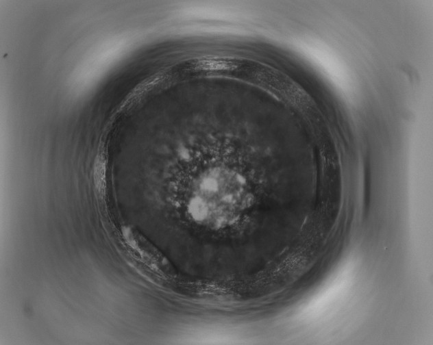 X0000110860387200906181145