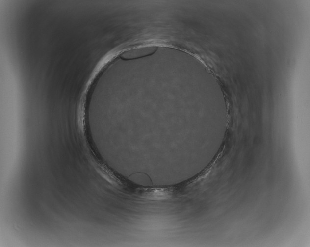 X0000110860056200906251216