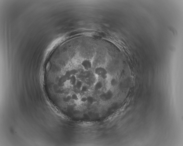 X0000110870149200906181209