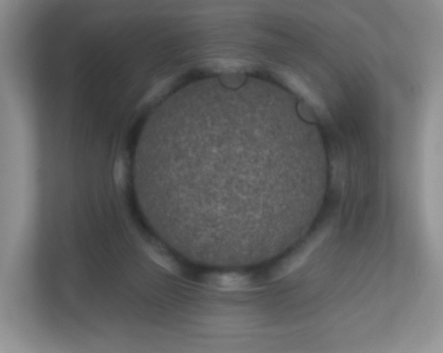X0000110920165200906251425
