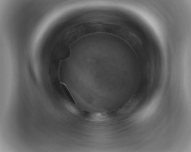 X0000110920239200906251424