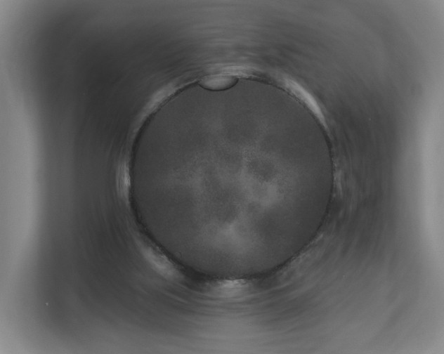 X0000110940059200906191239