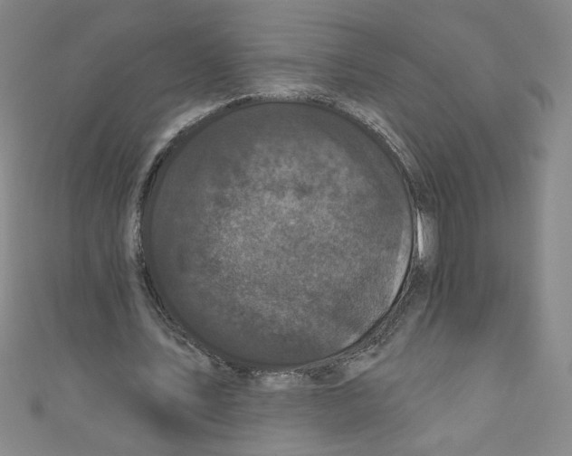 X0000110940579200907171610