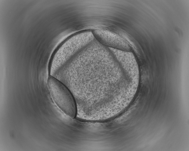 X0000110940940200907171605