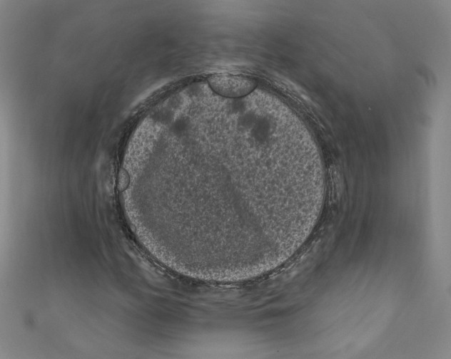 X0000110941158200907171602