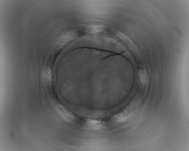 X0000110960380200907171654