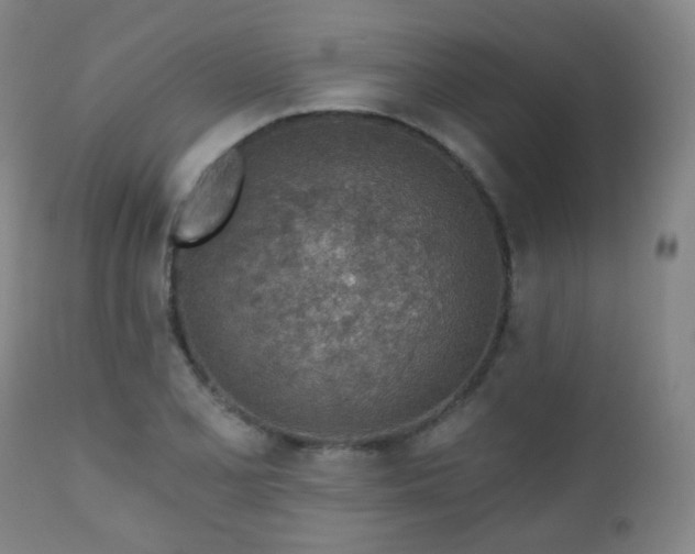 X0000110981077200906191358