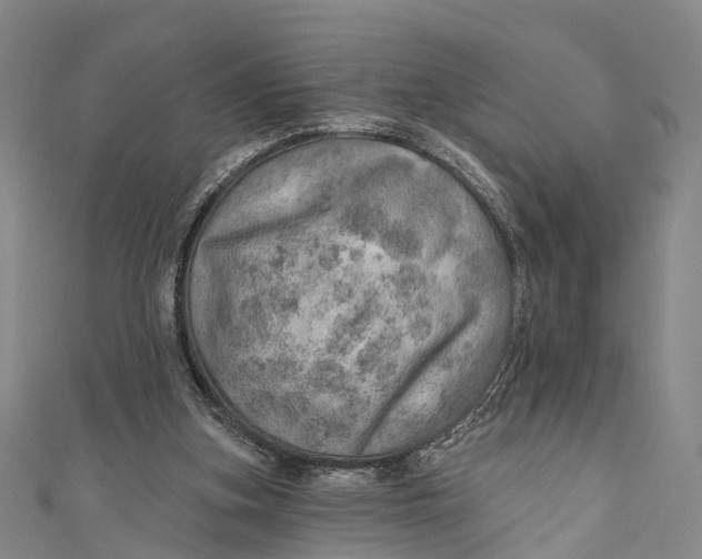 X0000110980155200907101417