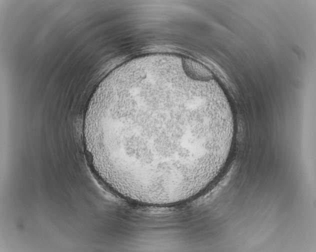 X0000110980849200907171730