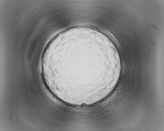 X0000110981036200907171727