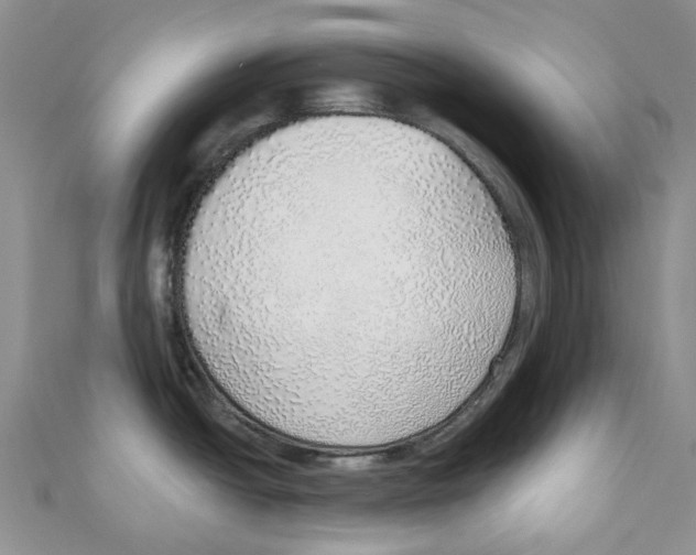 X0000110981438200907171722