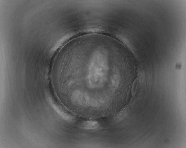 X0000110990159200906191435
