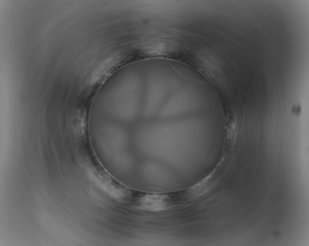 X0000110990179200906191435