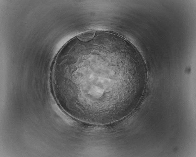 X0000110991187200906191420