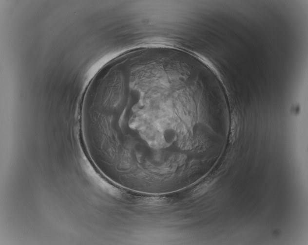 X0000110991387200906191417