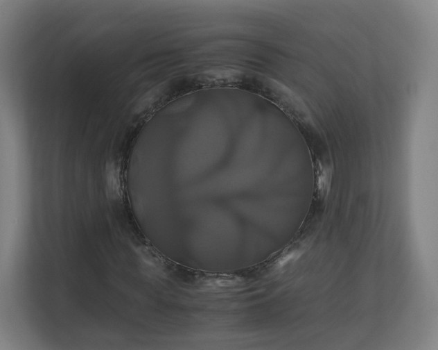 X0000110990819200906261448