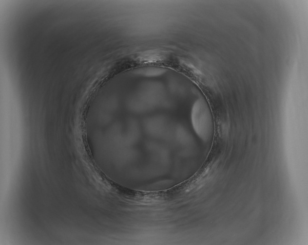 X0000110991393200906261440