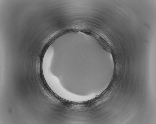 X0000110990446200907171755