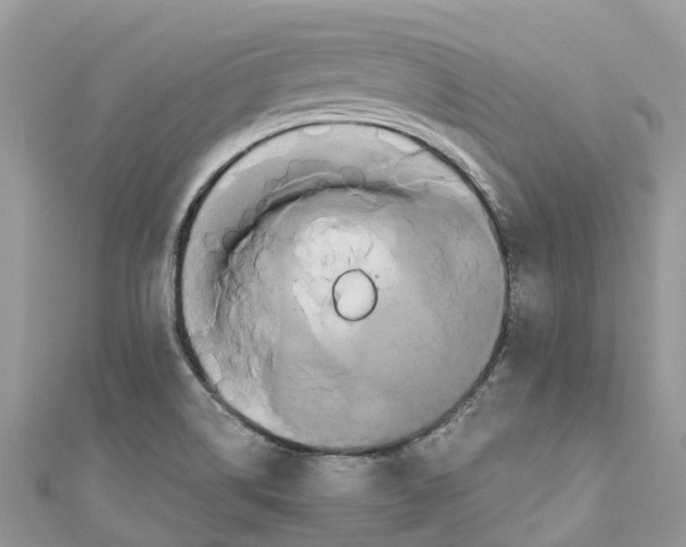 X0000110991514200907171741