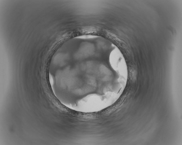 X0000110991393200907311000