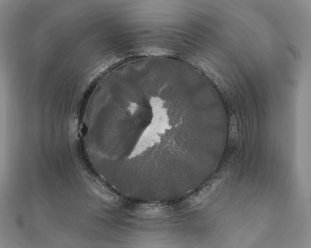 X0000111000351200906191555