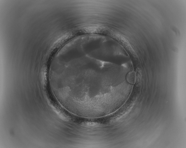 X0000111000590200906261500