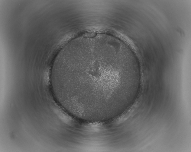 X0000111000065200907171822