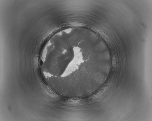 X0000111000351200907171818